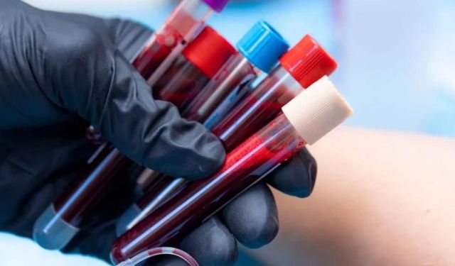 En zeki insanlar bu kan grubuna sahip! Zekanızı belirleyebilir mi?