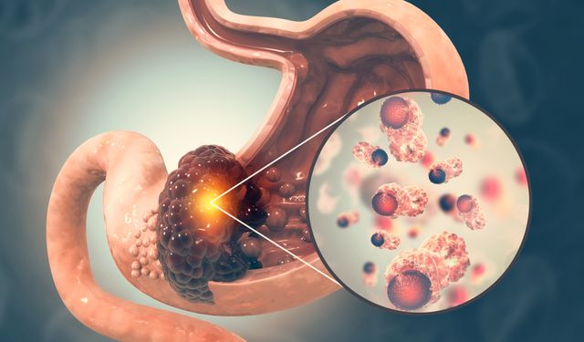 Kanser Erken Belirti Verir mi?