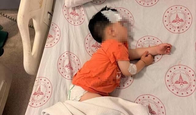 Şanlıurfa'da Sokak Köpeklerinin Saldırdığı Çocuk Hastaneye Kaldırıldı