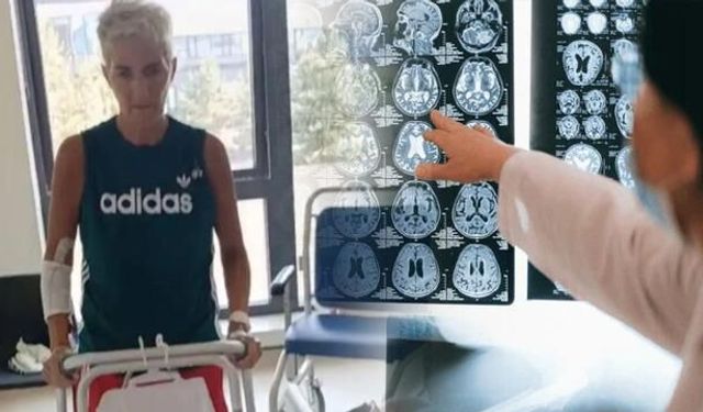 Fonksiyonel Nörolojik Bozukluk Teşhisiyle Felç Şüphesi Sonlandı