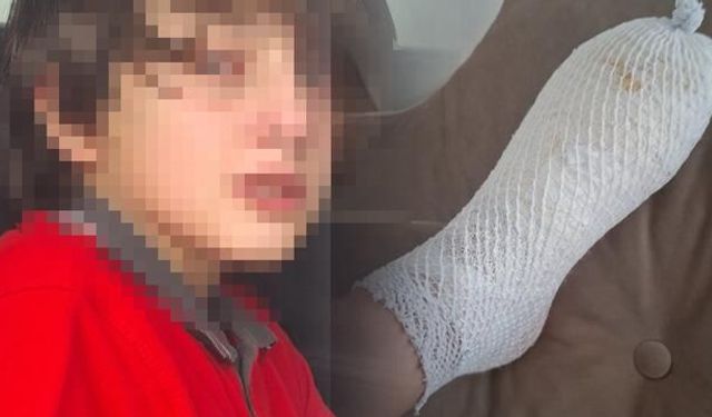 Ankara'da oyuncak patladı, 11 yaşındaki Furkan'ın ayağında 2'nci derece yanık oluştu