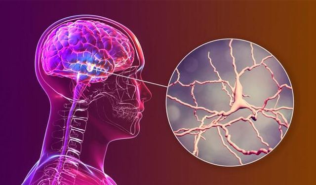 Yüksek Radyasyon Beyinde Alzheimer Riskini Artıran Zincirleme Reaksiyonları Tetikliyor