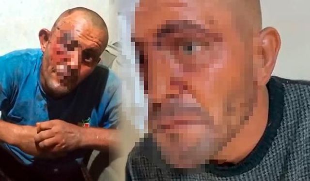 Adana'da sosyal medyada tanınan zihinsel engelli Selçuk Demir darbedildi