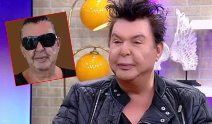 Kuşum Aydın'ın Yüz Gerdirme Ameliyatı Sonrası Değişimi Beğeni Topladı