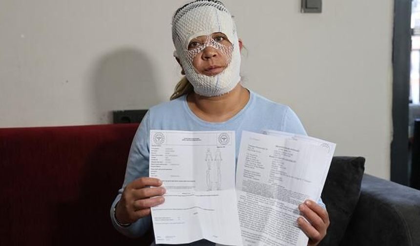 'Prenses Cilt Bakımı' Sonrası Yaşanan Yanık Vakası