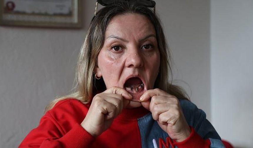 Sivas'ta Diş Ağrısıyla Gitti, 25 Dişi Çekildi