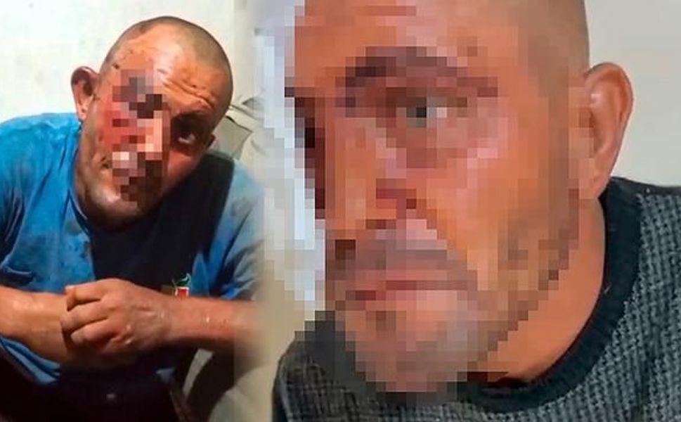 Adana'da sosyal medyada tanınan zihinsel engelli Selçuk Demir darbedildi